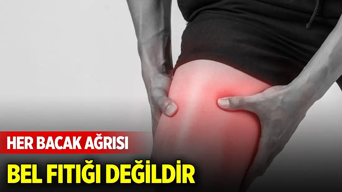 Her bacak ağrısı bel fıtığı değildir: Piriformis sendromuna dikkat!