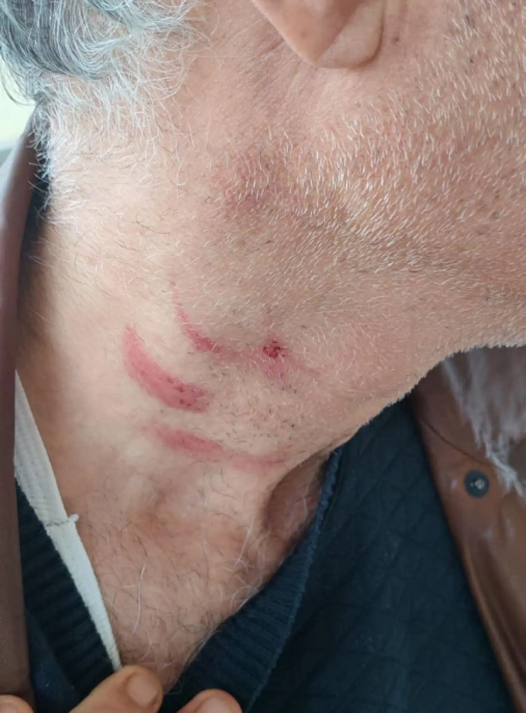Konya merkezde hekime saldırı olayında yeni gelişme!