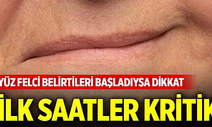 Yüz felcinde ilk saatler kritik... Erken müdahale kalıcı hasarı önlüyor
