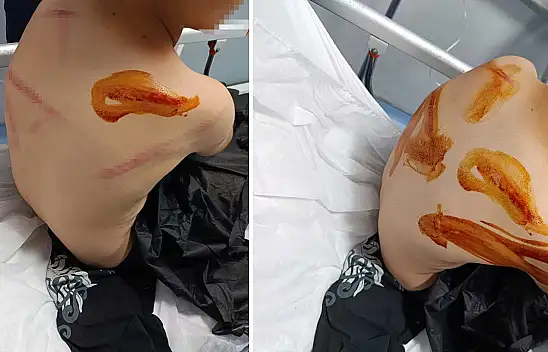 17 yaşındaki genç, 11 yaşındaki komşu çocuğunu sopayla öldüresiye dövdü!