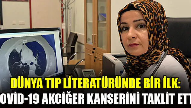 Dünya tıp literatüründe bir ilk: Kovid-19 akciğer kanserini taklit etti