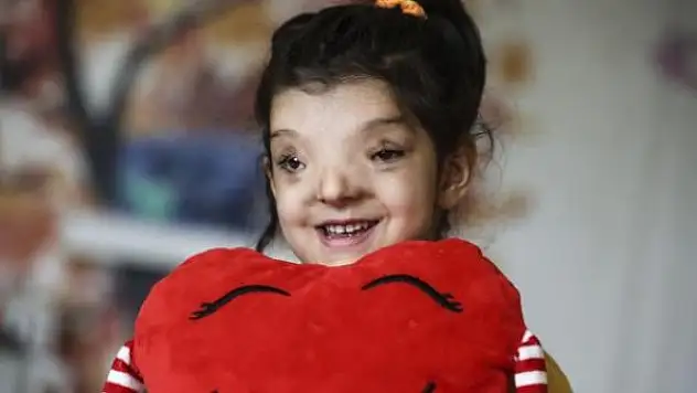 Minik Ayşenur'un normalden daha ayrık olan gözleri ameliyatla yaklaştırıldı