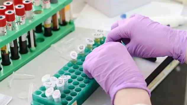 Evlilik öncesi SMA taraması başladı