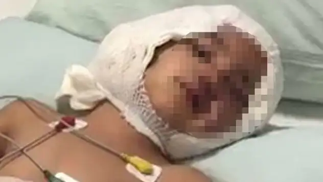 Pitbull saldırısına uğrayan Asiye'nin doktoru: 7-10 günlük süreç çok kritik