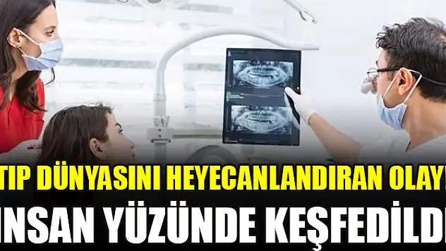 Tıp dünyasını heyecanlandıran olay! İnsan yüzünde keşfedildi