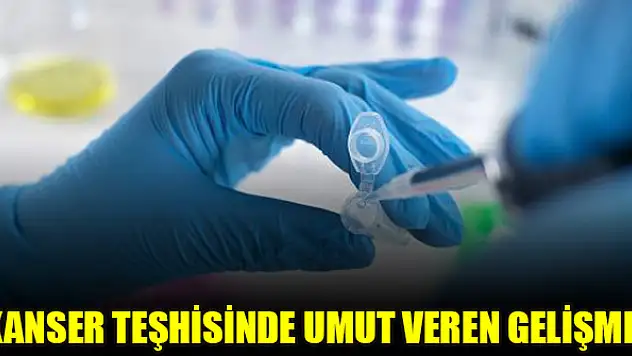 Kanser teşhisinde umut veren gelişme