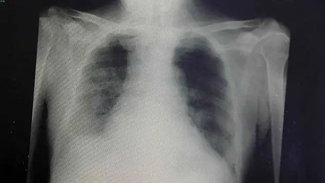 Uzmanlar, Kovid-19'un birkaç ay içerisinde biteceğini öngörüyor