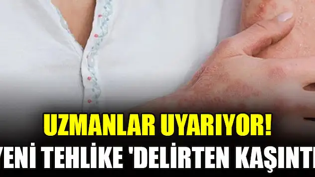 Uzmanlar uyarıyor! Yeni tehlike 'delirten kaşıntı'