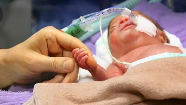 800 gramlık bebeğin kalbine hassas operasyon
