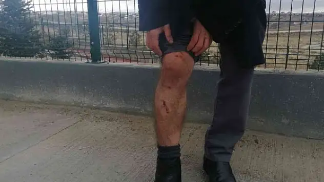 Köpek sürüsünün saldırısına uğramıştı, korku dolu o anları anlattı