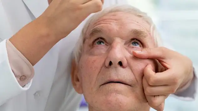 '75 yaşın yüzde 20'sinde görülüyor, görme kaybına sebep olabilir'