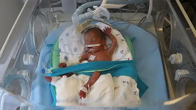 'Parmak bebek' Yavuz Selim kök hücre nakliyle hayata tutundu