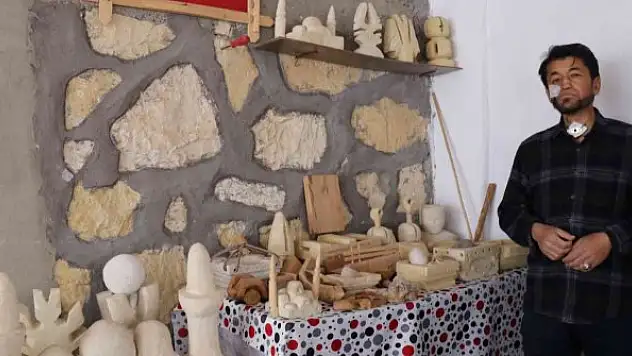 Kansere yakalandı, sanatla hayata tutundu