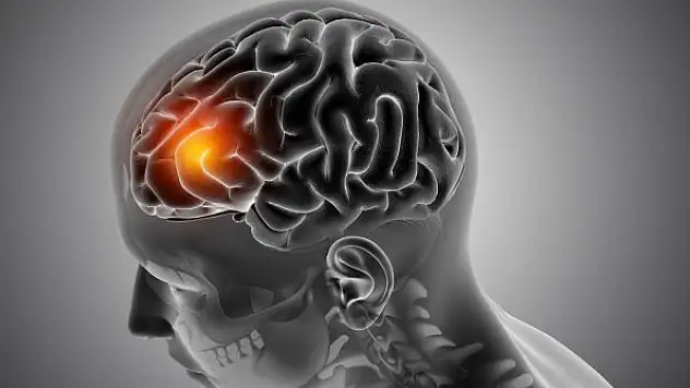 Dr. Kahya: 'Epilepsi genellikle zeka ve diğer beceriler üzerinde olumsuz etki oluşturmaz'