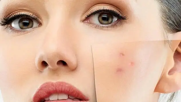 Hassas ve alerjik ciltlere mevsim geçişlerinde dikkat