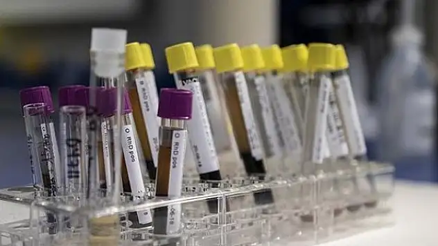 DSÖ: Avrupa ve ABD'de en az 169 'gizemli hepatit' vakası var