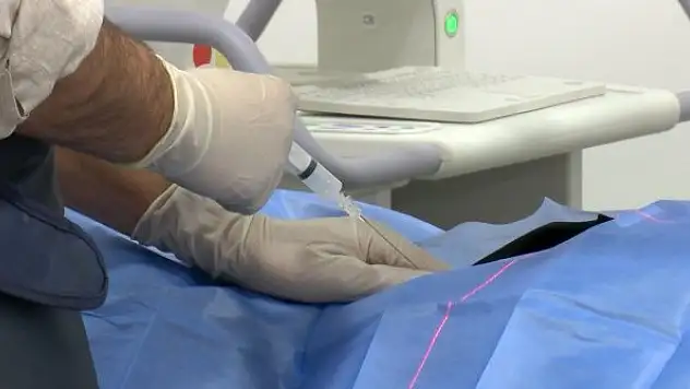 Fıtıkta ameliyatsız tedavi dönemi yüzde 90 olumlu sonuç alınıyor