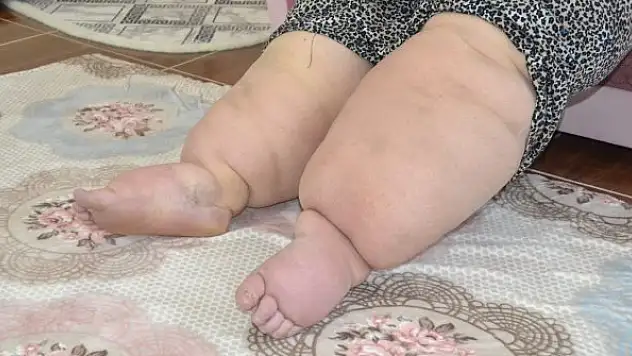 15 yıldır hastalığına teşhis konulmayan kadının hayatı kabusa döndü