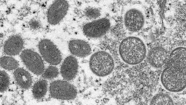 Maymun çiçeği virüsü nasıl ortaya çıktı?