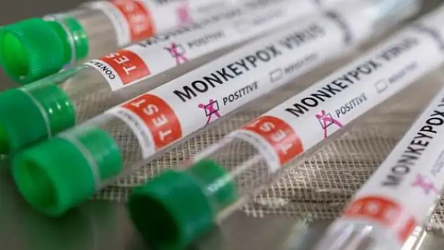 İspanya'da 52 şüpheli maymun çiçeği vakası var