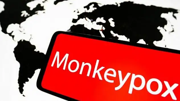 DSÖ: 16 ülkede 250'den fazla maymun çiçeği vakası görüldü