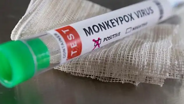 Maymun çiçeğine potansiyel antiviral tedavi