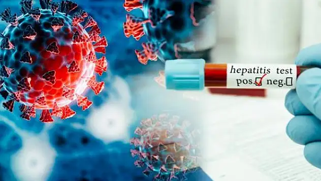 Gizemli hepatit vakaları 650'ye, can kayıpları 9'a yükseldi