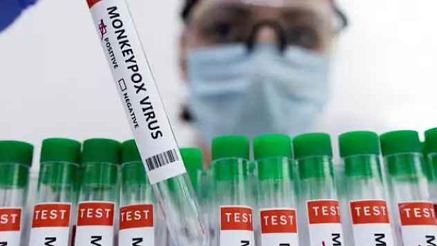 DSÖ, dünyada 550 maymun çiçeği vakası bulunduğunu açıkladı