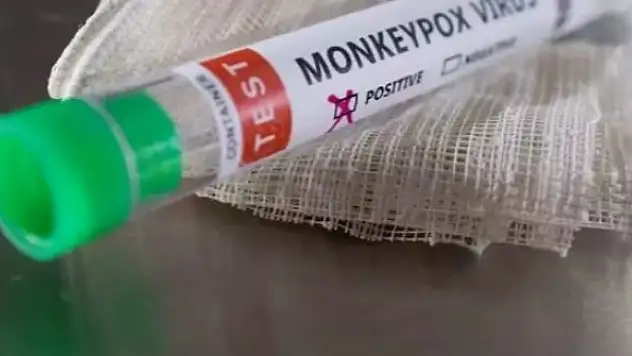 30 ülkede görüldü! Maymun çiçeğinde ilk yasak geldi