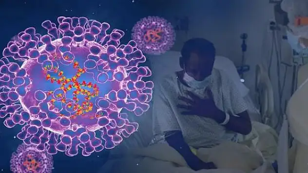 En fazla maymun çiçeği vakası Avrupa'da