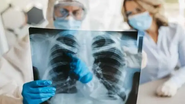 Kötü haberi DSÖ yetkilisi duyurdu: Birden fazla kez Covid'e yakalananlar dikkat!