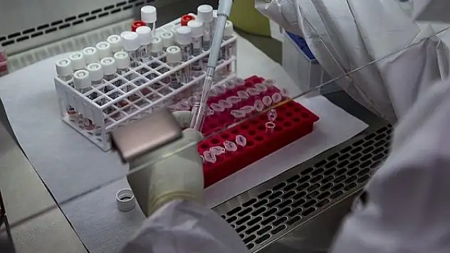 Avrupa'da son 2 haftada maymun çiçeği vakaları üçe katlandı