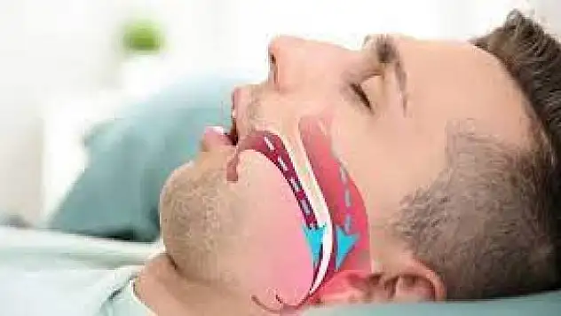 Trafik kazası riskini beş katına çıkaran hastalık: Uyku apnesi