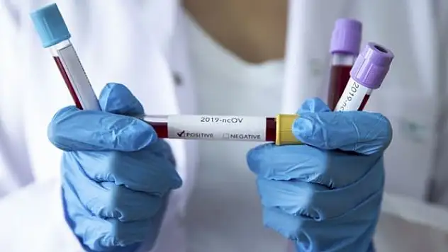 DSÖ'den yeni karar! Kovid-19 salgınını...