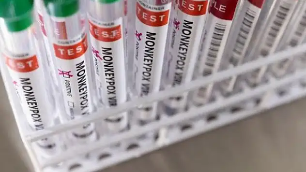 Maymun çiçeği Bosna Hersek'te de görüldü