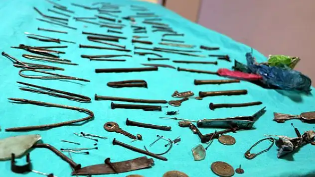 Midesinden 158 parça metal çıkarıldı! Çivi, bıçak, tırnak makası...