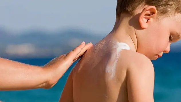 Güneş yanıklarına karşı bunu sakın yapmayın!