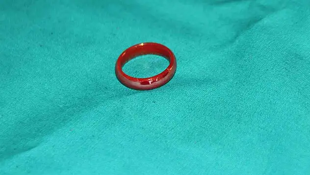 Oyun oynarken yerdeki yüzüğü yutan 3 yaşındaki çocuk ölümden döndü