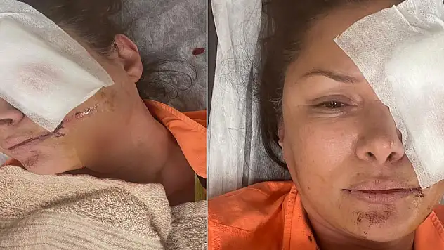 Şarkıcı Tuğba Altıntop köpek saldırısına uğradı