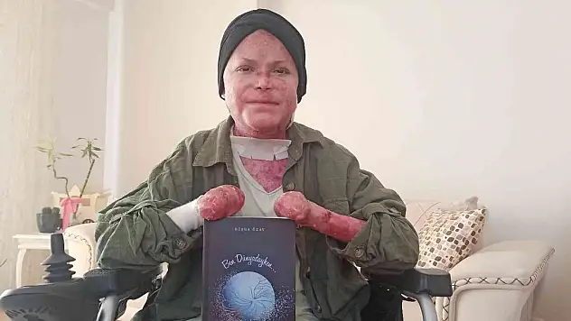 Kelebek hastası Büşra günlüklerini kitap haline getirdi