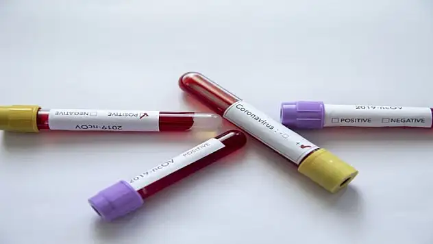 Koronovirüs daha çok erkekleri vurdu