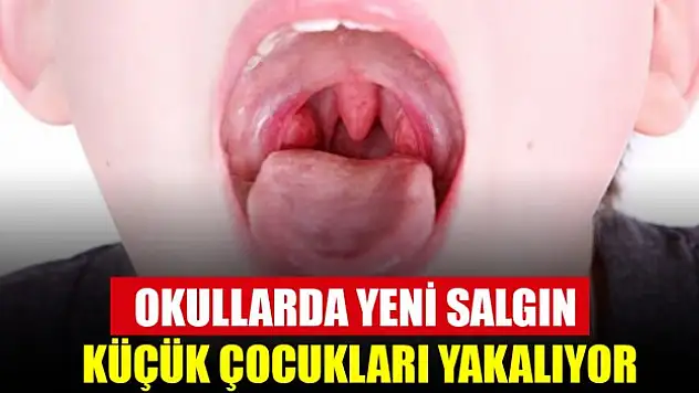 Okullarda yeni salgın: Özellikle küçük çocukları yakalıyor