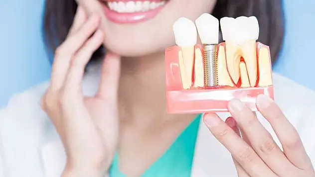 İmplant nedir ve nasıl yapılır? 7 adımda implant hakkında merak edilenler