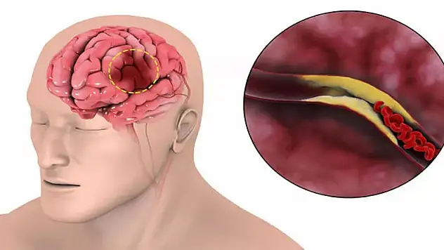 Her dört kişiden birinin başına geliyor