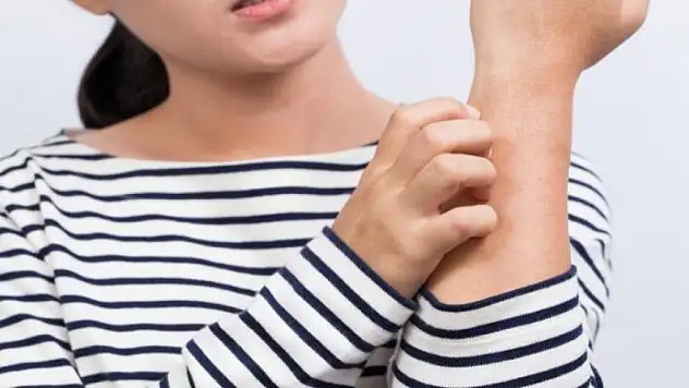 Vücutta kaşıntı hangi hastalığın belirtisi? Kaşıntı neden olur? Kaşıntıya ne iyi gelir?