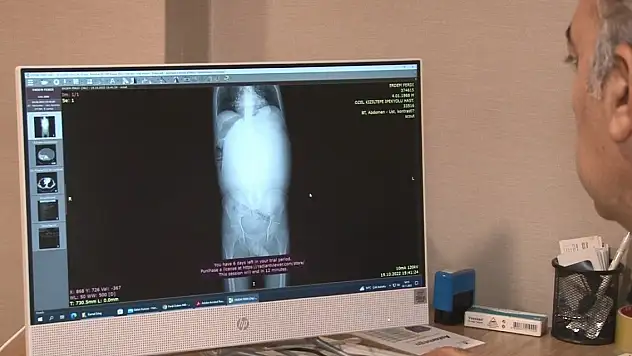 Mide şikayeti ile gitti, böbreğinde 60 santim kist çıktı