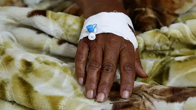 Kamerun'daki kolera salgınında 426 kişi öldü