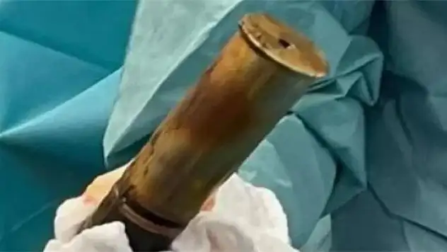 Anüsüne top mermisi sıkışan kişi acile gitti, hastane patlama riskine karşı tahliye edildi