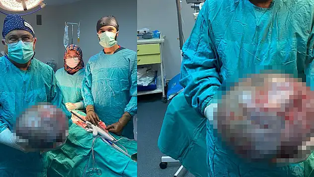 Karın ağrısıyla hastaneye gitti, karnından 8 kiloluk kitle çıktı