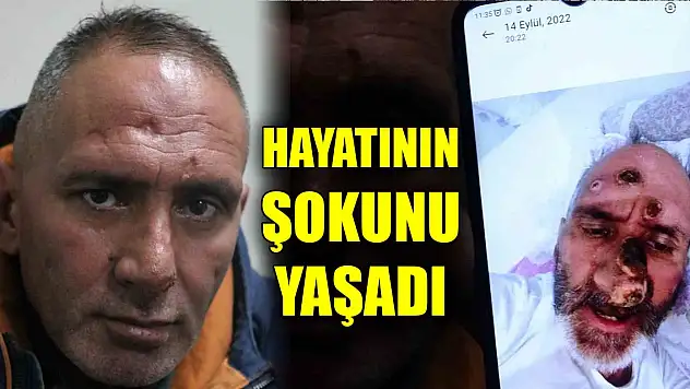 Çalışmak için gittiği şehirde hayatının şokunu yaşadı!
